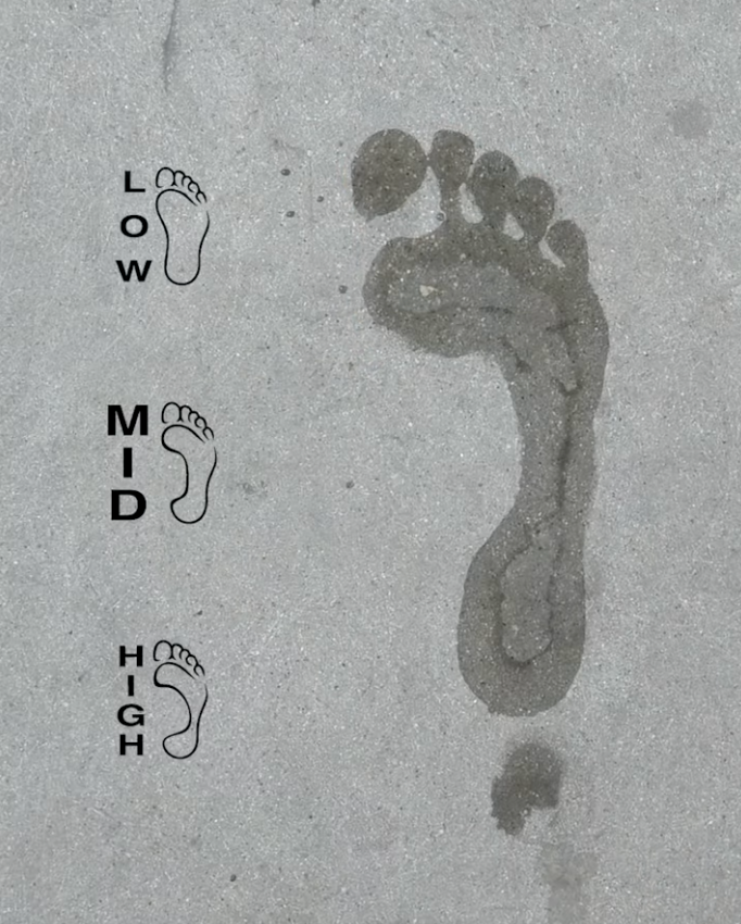 What’s My Foot Arch Type? Low, Mid, and High Arches Explained